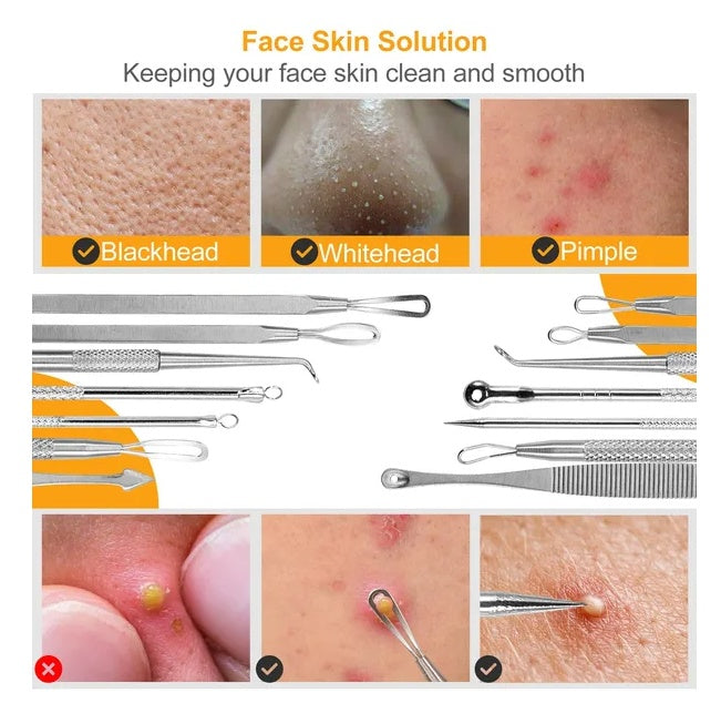 7 Pcs Blackhead Remover Kit Stainless Steel Pimple Comedone Acne Extractor Needle Tools