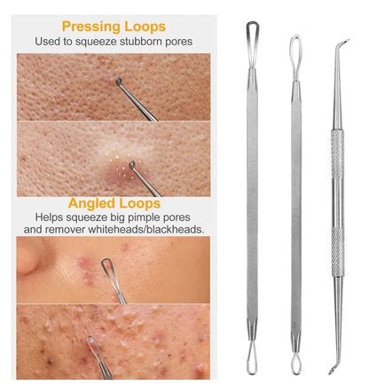 7 Pcs Blackhead Remover Kit Stainless Steel Pimple Comedone Acne Extractor Needle Tools